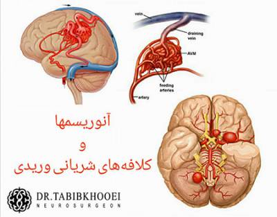 جراحی مغز و اعصاب,جراح مغز و اعصاب در ایران